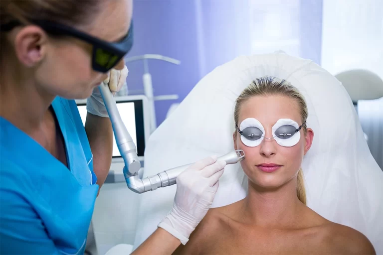 Laser Treatment
