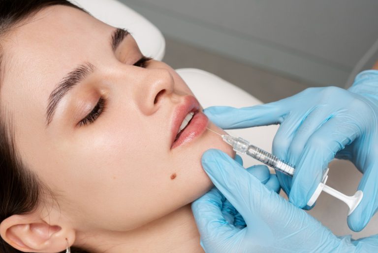 lip fillers in Peterborough, UK